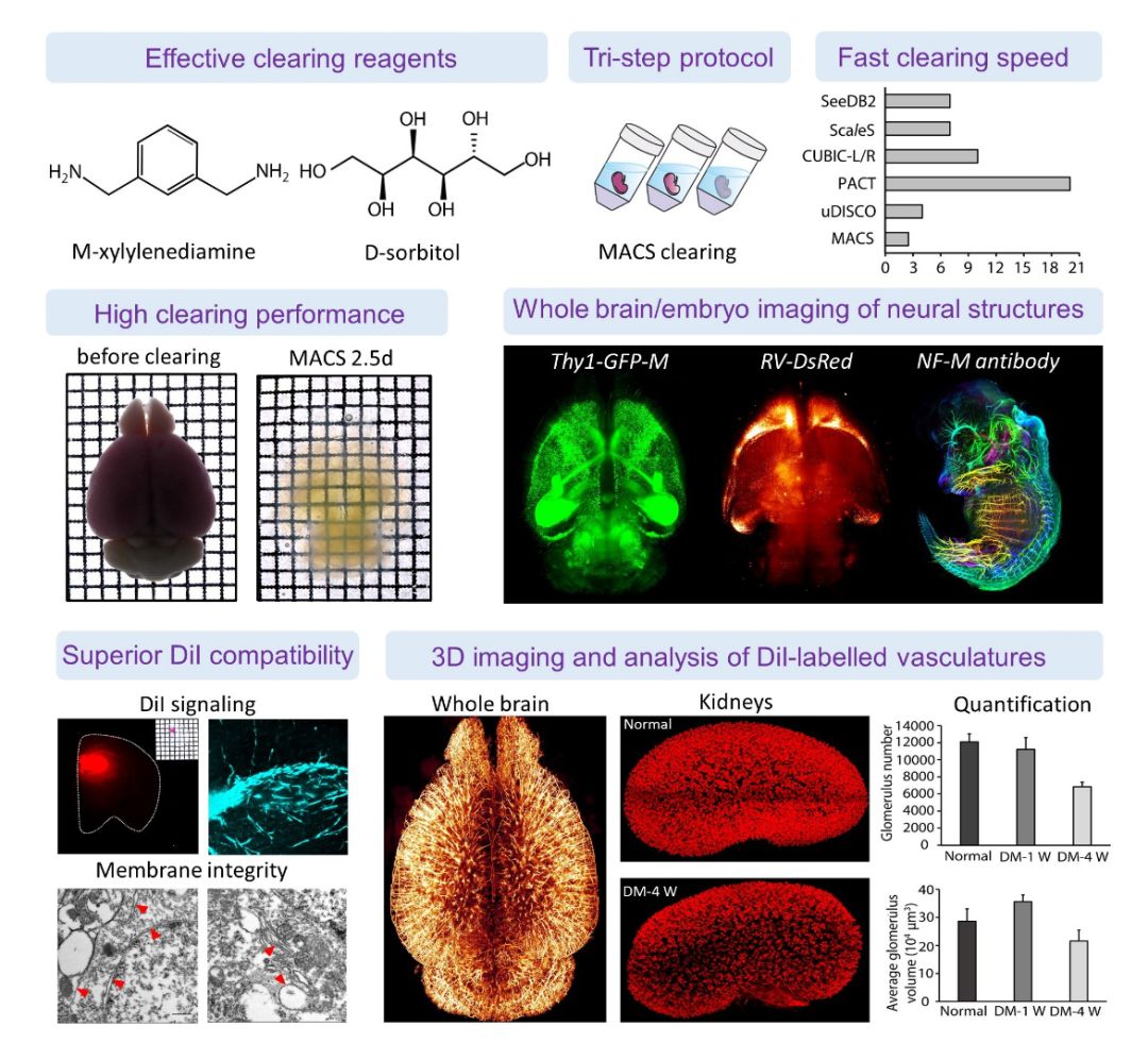 Advanced Science:   MACS:新型快速水溶性光透明方法用于整体器官成像(图1)