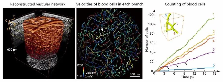 新型光场显微镜高速记录大脑神经元活动和血流的快速动态变化(图5)